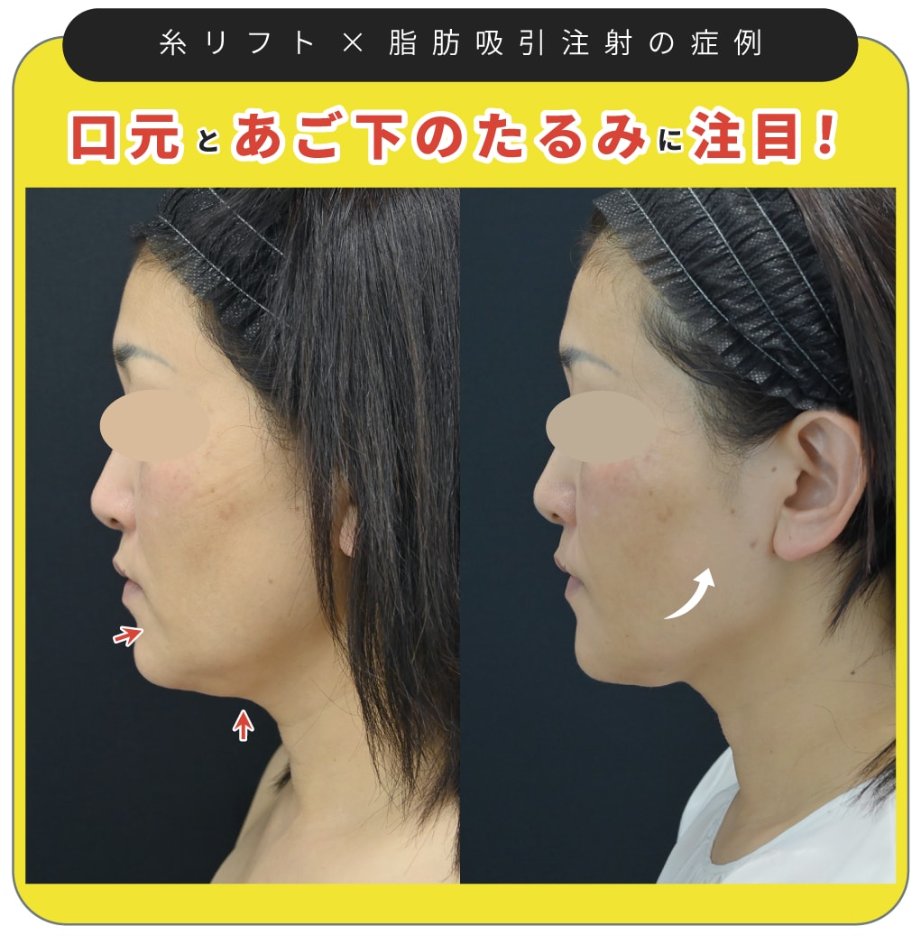 ５０代女性の症例